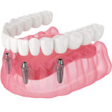 all on x dental madison heights