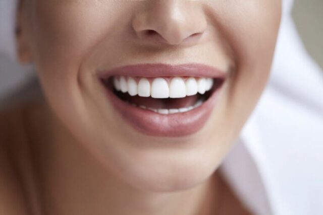 cosmetic dentist troy