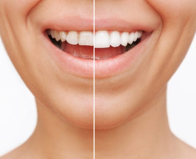 cosmetic dentist troy