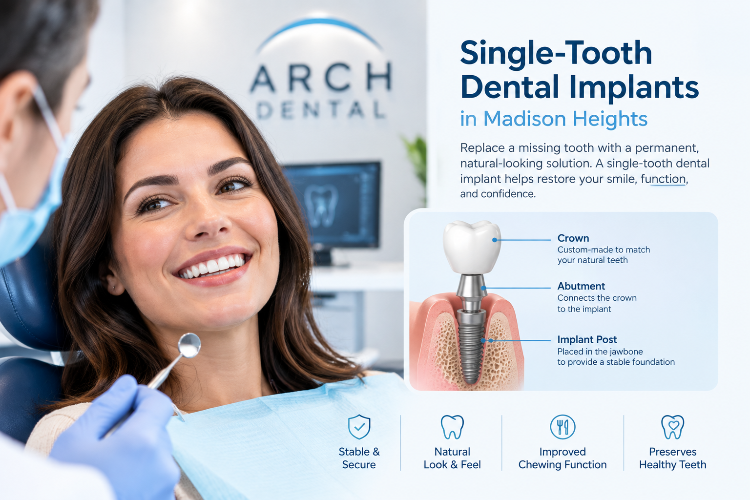 Single Dental implants in Madison Heights